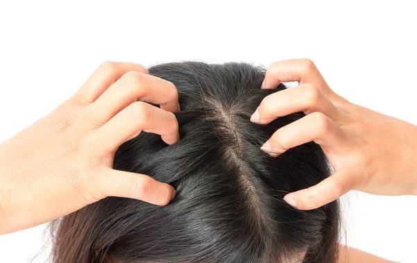 dandruff and itchy scalp solutions